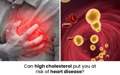 Can high cholesterol put you at risk of heart disease?