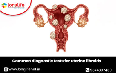 Common diagnostic tests for uterine fibroids