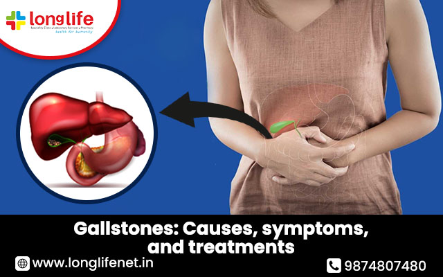 Gallstones: Causes, symptoms, and treatments