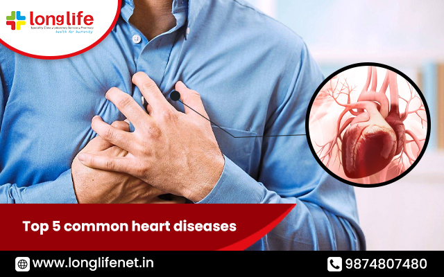Top 5 common heart diseases