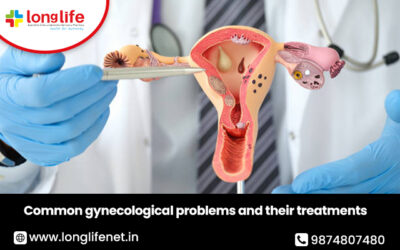 Common gynecological problems and their treatments