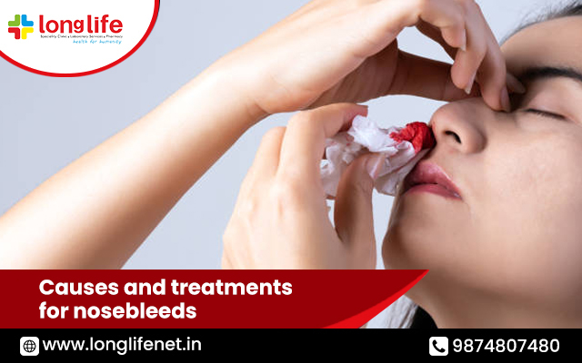Causes and treatments for nosebleeds
