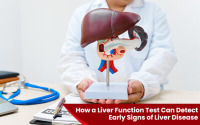 How a Liver Function Test can Detect Early Signs of Liver Disease?