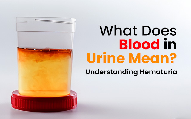 What Does Blood in Urine Mean? Understanding Hematuria