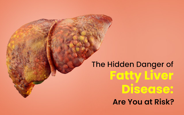 The Hidden Danger of Fatty Liver Disease: Are You at Risk?