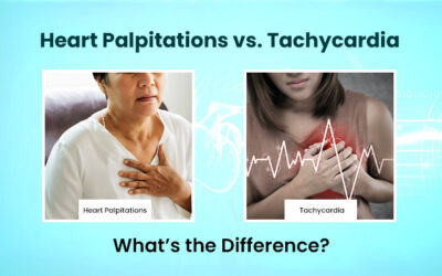 Heart Palpitations vs. Tachycardia: What’s the Difference?