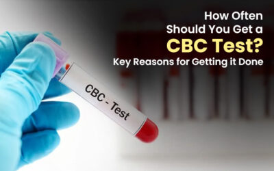 How Often Should You Get a CBC Test? Key Reasons for Getting it Done