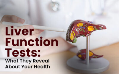 Liver Function Tests: What They Reveal About Your Health