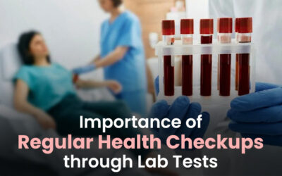 Importance of Regular Health Checkups through Lab Tests