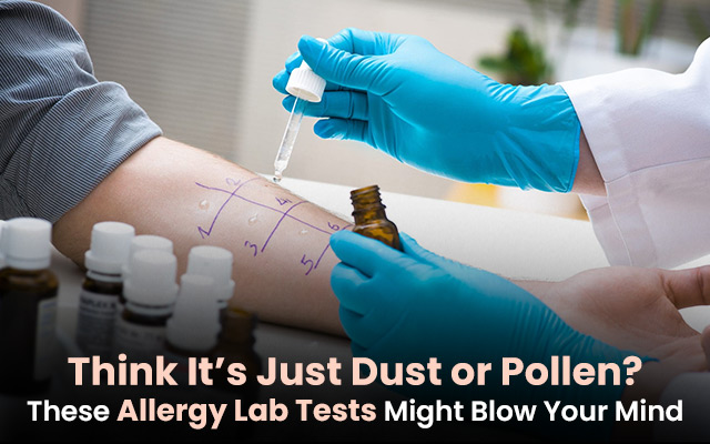 Allergy Lab Tests