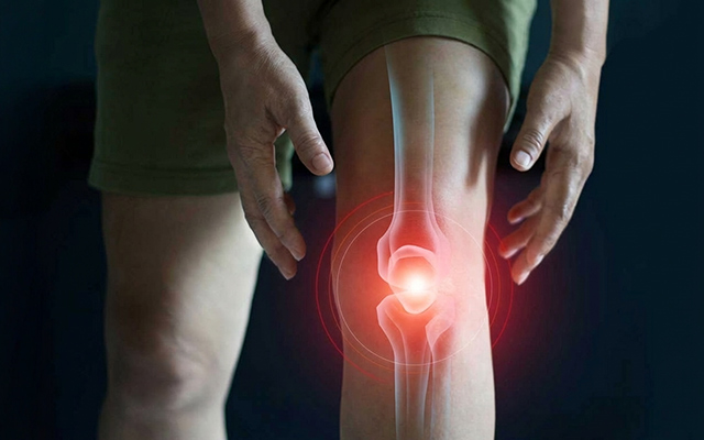 Close up of knee joint inflammation showing pain and arthritis discomfort concept
