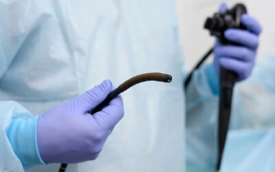 What Diseases Can an Endoscopy and Biopsy Detect, and Does Taking a Biopsy Mean Cancer Is Suspected? 